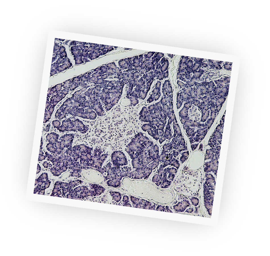 Paul Langerhans discovered islets of cells in the pancreas